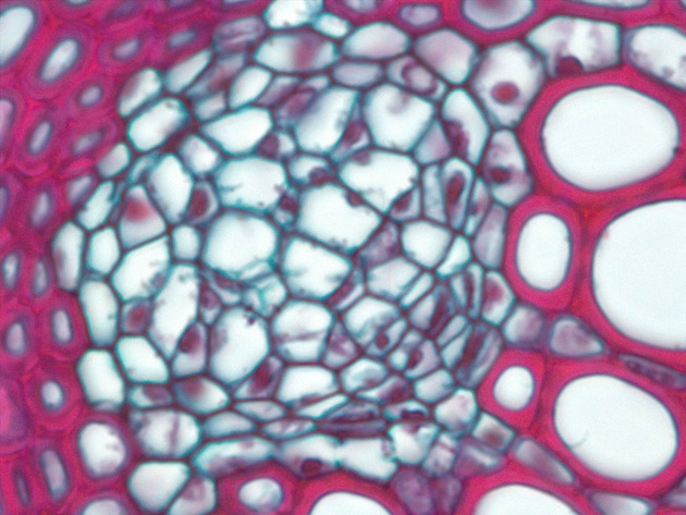 Plant Vascular Tissue Slides - Plant Vascular Tissue 01 1000X